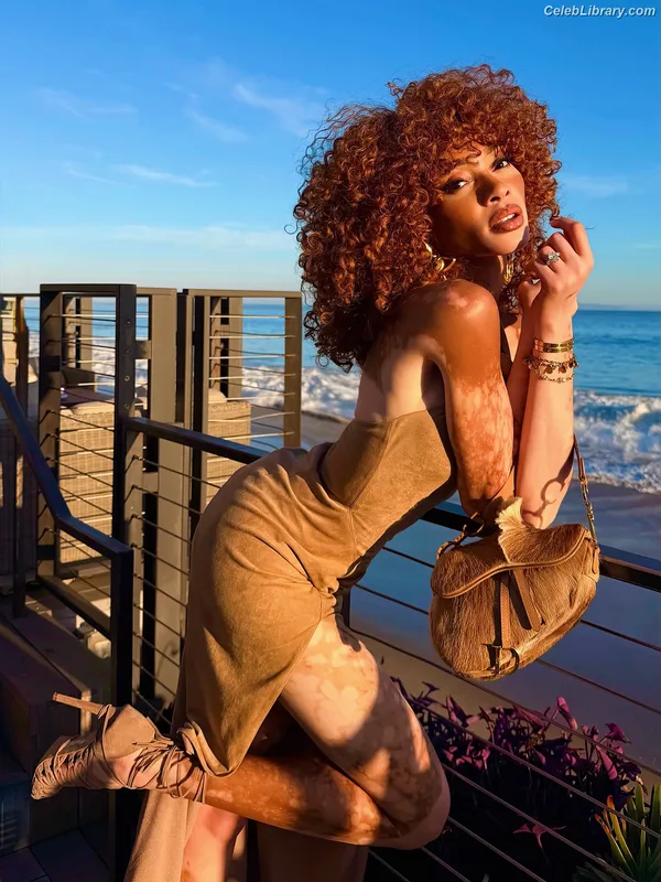 Winnie Harlow photo 2 of 56