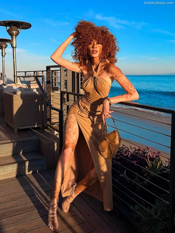 Winnie Harlow photo 3 of 56