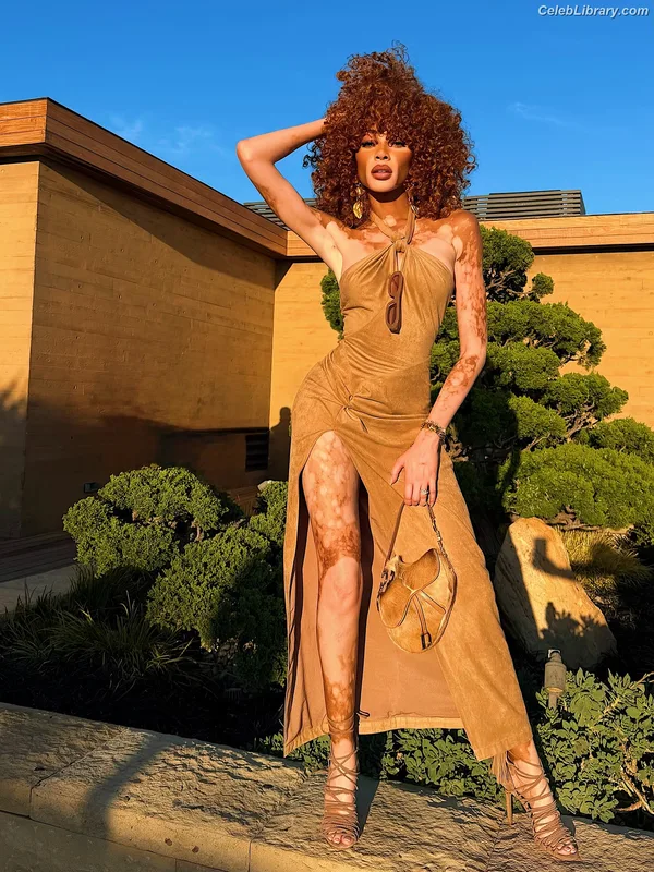 Winnie Harlow photo 6 of 56