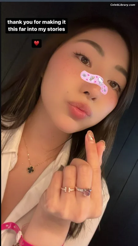 xChocobars photo 17 of 762
